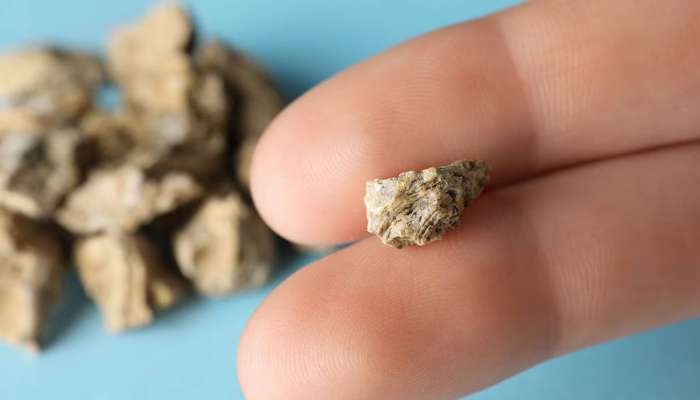 Kidney Stone: પથરીનો સાવ મફત ઈલાજ, ઓપરેશન વિના તુટીને નીકળી જશે પથરી, ખાલી પેટ ખાવું આ લીલું પાન