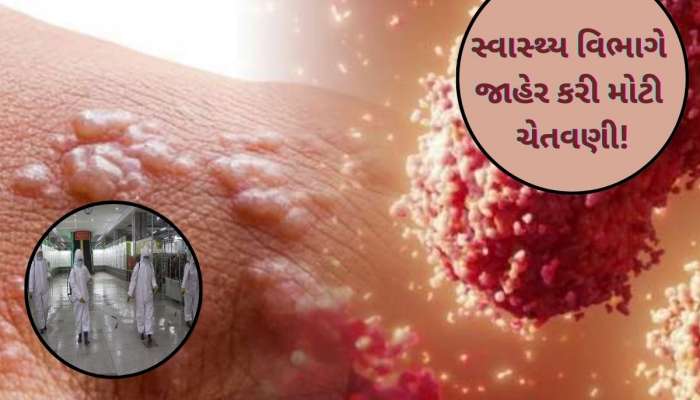 સાવધાન! HMPV બાદ ભારતમાં આ જીવલેણ વાયરસની એન્ટ્રી, દેશમા પહેલો કેસ, આ લોકોને છે ખતરો