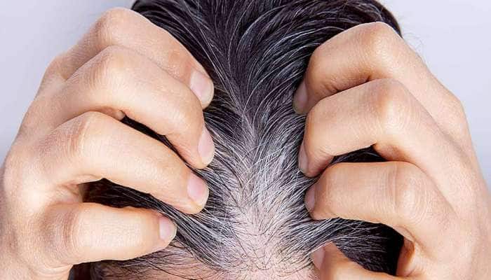 White Hair: સફેદ વાળને કેમિકલ હેર કલર વિના કરો કાળા, ઘરે બનાવી લો આ ચમત્કારી તેલ