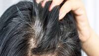 White Hair: સફેદ વાળ મૂળમાંથી કાળા થઈ જશે, સરસવના તેલમાં આ 3 વસ્તુઓ મિક્સ કરી લગાડો 