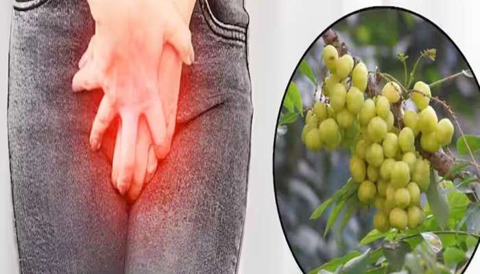 Health Tips: પેશાબમાં થતી બળતરાને શાંત કરવા અપનાવો આ 3 દેશી ઈલાજ, તુરંત મળશે આરામ