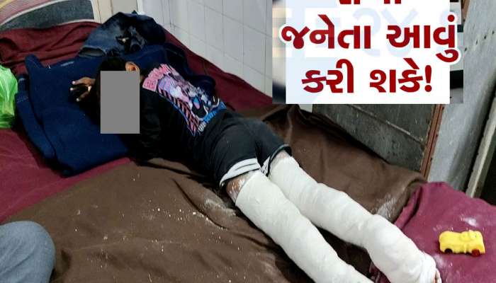 આ બાળક કોનું છે? આણંદમાં રઝળતું મળી આવ્યું 5 વર્ષનું બાળક, માસુમના બંને પગમાં ફ્રેક્ચર   