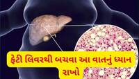 આ 5 પ્રકારના ફૂડ્સ વધારે છે ફેટી લિવરનો ખતરો, દરરોજ સેવન કરશો તો ભારે પડશે
