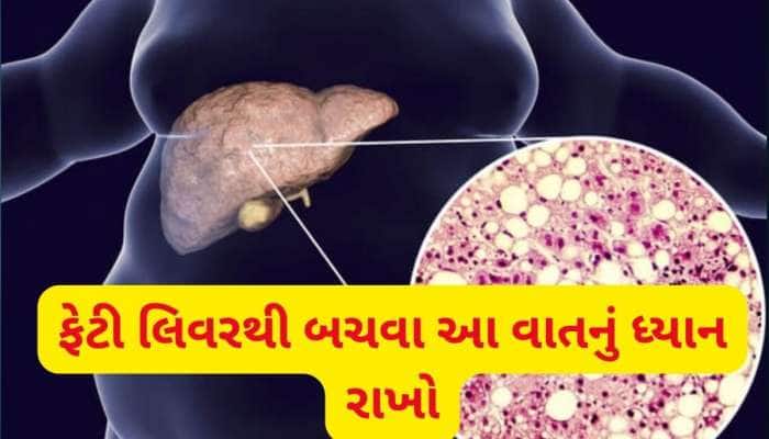 આ 5 પ્રકારના ફૂડ્સ વધારે છે ફેટી લિવરનો ખતરો, દરરોજ સેવન કરશો તો ભારે પડશે