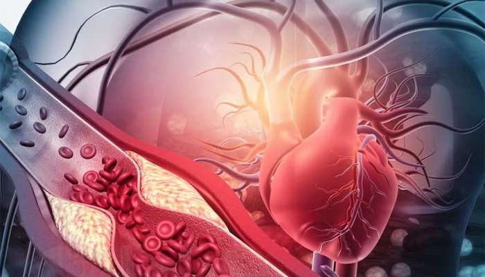 Heart Blockage Signs: ધમનીઓ બ્લોક હોય ત્યારે શરીરમાં દેખાય આ લક્ષણો, 5 માંથી 1 ને પણ ઈગ્નોર ન કરતાં