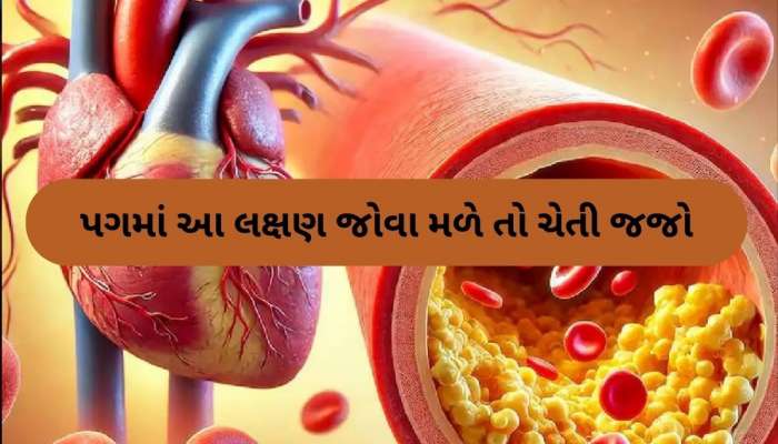 તમારા પગ ચીસો પાડી પાડીને આપશે હાઈ કોલેસ્ટ્રોલના સંકેતો, અવગણના કરશો તો ભારે પડશે