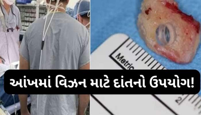 કેનેડામાં અનોખુ ઓપરેશન, આંખની રોશની પાછી લાવવા માટે દાંતનો ઉપયોગ