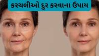 Skin Care: ઢીલી પડેલી સ્કિન પણ ટાઈટ થશે, લીંબુના રસમાં આ વસ્તુ ઉમેરી લગાડો સ્કિન પર