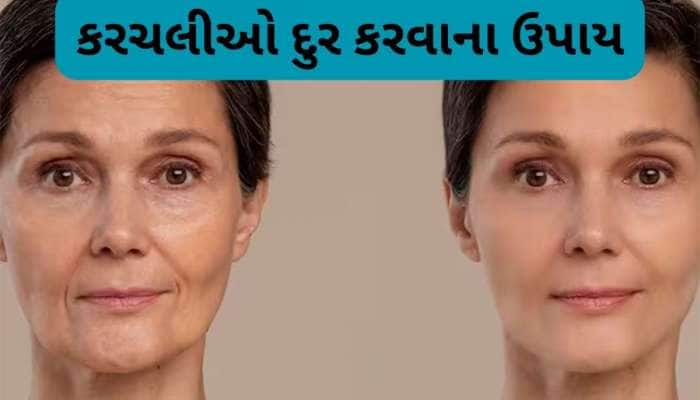 Skin Care: ઢીલી પડેલી સ્કિન પણ ટાઈટ થશે, લીંબુના રસમાં આ વસ્તુ ઉમેરી લગાડો સ્કિન પર