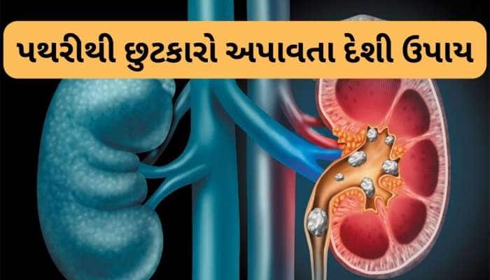 Kidney Stone: મોટી પથરીને પણ ઓગાળી શકે છે આ 2 દેશી વસ્તુઓ, દુખાવાથી પણ આપે રાહત