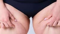 Lower Body Fat: કમર નીચેના અંગો પર વધતી ચરબી આ બીમારીનું લક્ષણ હોય શકે છે