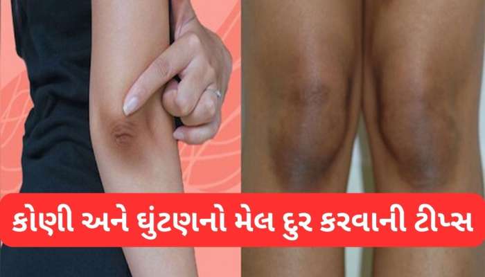 Dark Elbow-Knee: કોણી અને ઘુંટણની કાળી સ્કિન ગોરી થઈ જશે, આ રીતે રોજ લગાડો ચણાનો લોટ