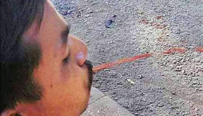 Viral News: ગૂટકા ખાઈને થૂંકતા પહેલા હજારવાર વિચાર કરજો, પરેશાન થઈને પોલીસ બોલાવી