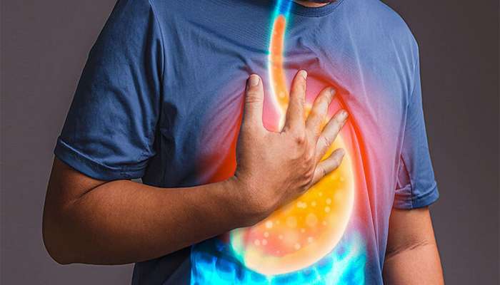 Acidity: 5 મિનિટમાં એસિડિટી મટાડી દે એવા જોરદાર છે આ 3 ઉપાય, પેટ અને છાતીની બળતરા તુરંત શાંત થશે