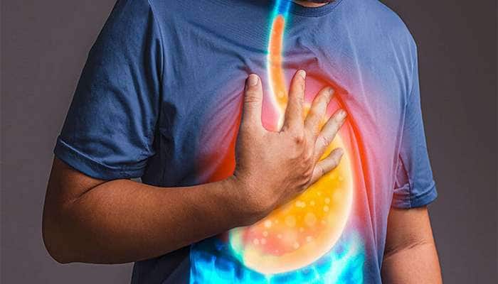 Acidity: 5 મિનિટમાં એસિડિટી મટાડી દે એવા જોરદાર છે આ 3 ઉપાય, છાતીની બળતરા તુરંત મટશે