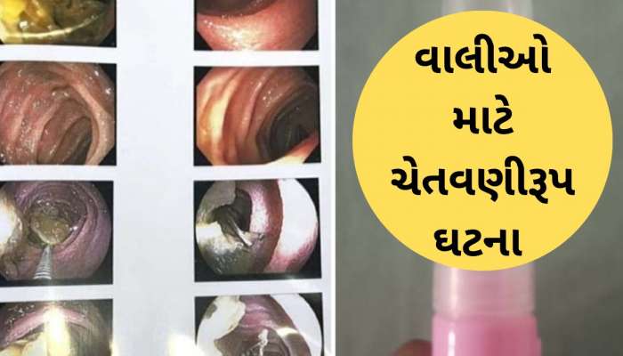 5 રૂપિયાની ચોકલેટ 35 હજારમાં પડી, વડોદરા ડેસર ગામમાં 4 વર્ષની બાળકી LED બલ્બ તાર સાથે ગળી ગઇ...