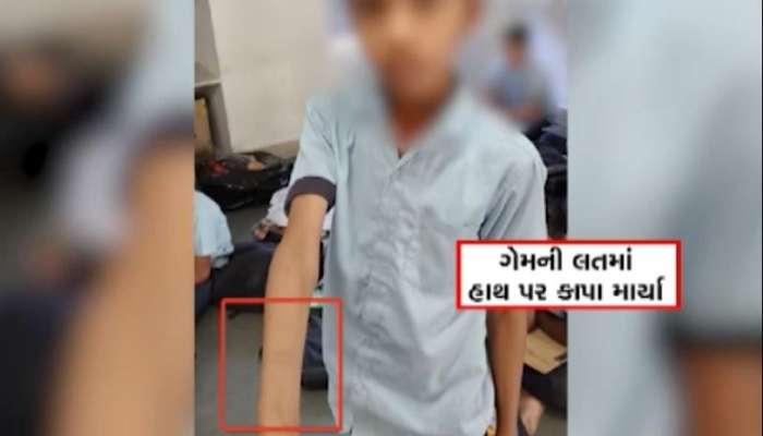 ગેમની લતમાં 40 વિદ્યાર્થીઓએ હાથ પર કાપા માર્યા, શિક્ષણ જગતમાં ખળભળાટ મચાવતી ઘટના