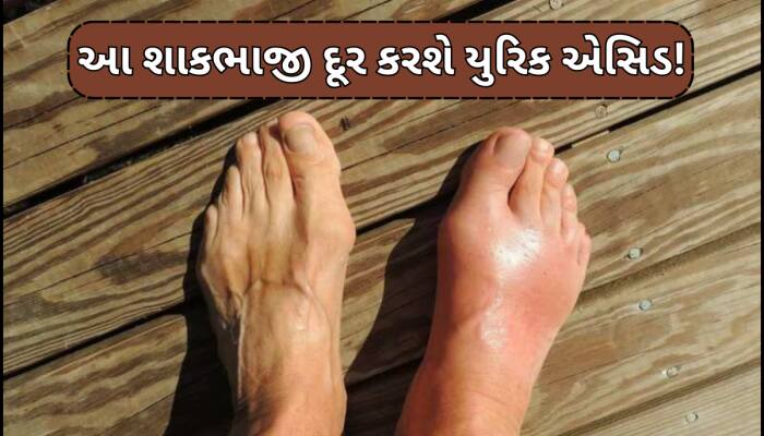 આ 5 શાકભાજી ઓછું કરે છે યુરિક એસિડ,સાંધામા જામેલા દર્દનાક ક્રિસ્ટલ થશે શરીરમાંથી દૂર