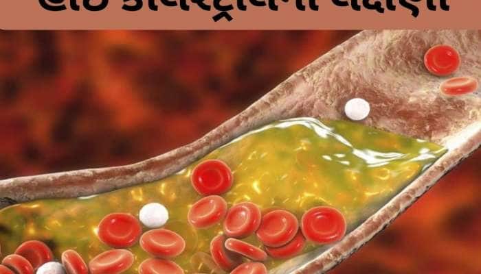 cholesterol: જો શરીરના આ ભાગમાં દુખાવો થતો હોય તો સમજો કે કોલેસ્ટ્રોલ વધી ગયું છે
