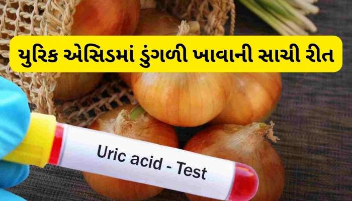 યુરિક એસિડ માટે રામબાણ છે ડુંગળી, બસ આ રીતે કરો સેવન