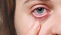 Dry Eye: કલાકો સુધી રીલ્સ જોવાની આદત આંખ માટે મોટું જોખમ, તાત્કાલીક વાંચો આ ચેતવણી