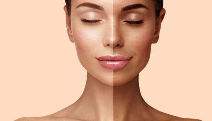 Skin Care: 4 નેચરલ ટૈન રિમૂવલ ફેસપેક, તડકાના કારણે કાળી પડેલી ત્વચા થશે ફરીથી ગોરી