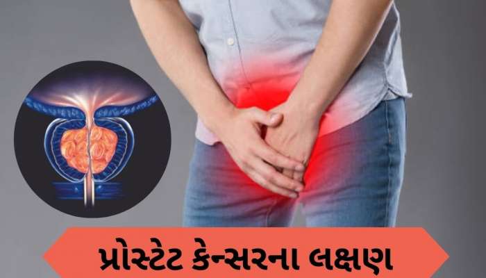 29 લાખ પુરૂષો 2040 સુધી થઈ શકે છે પ્રાઇવેટ પાર્ટના કેન્સરનો શિકાર, રિપોર્ટમાં દાવો, આ લક્ષણોને હળવાશથી ન લો