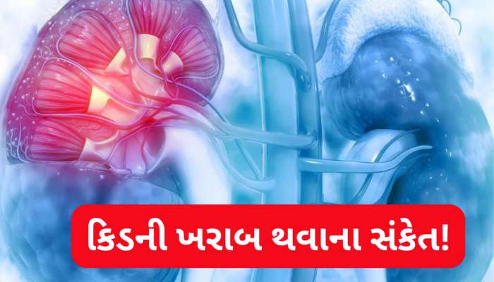 Healthcare: કિડની ખરાબ થાય તો ચામડી પર જોવા મળે છે આ 4 લક્ષણ, ઘરગથ્થું ઉપાય છોડી ડોક્ટર પાસે દોડો!