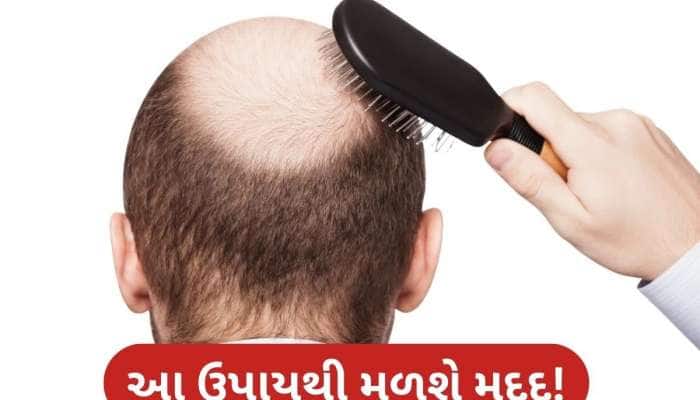 'ટાલ'ની સમસ્યા દૂર કરી શકે છે આ વર્ષો જૂનો આયુર્વેદિક નુસ્ખો! ફરી ઉગવા લાગશે નવા વાળ