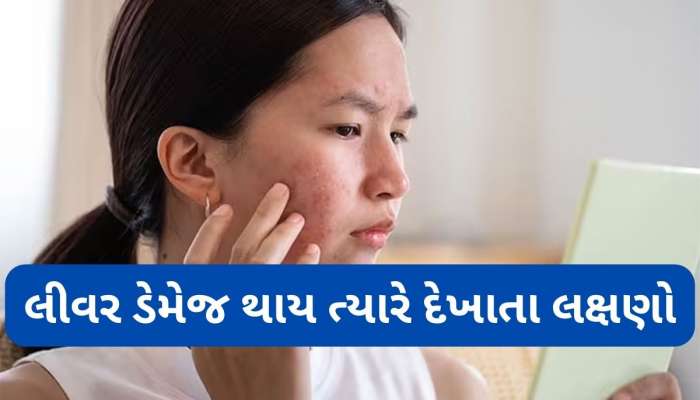Liver Damage: લિવર ડેમેજ થાય ત્યારે ચહેરા પર દેખાય છે આ 4 લક્ષણો, આ સ્કિન પ્રોબ્લેમ ને ઈગ્નોર ન કરો