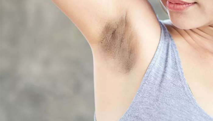 Dark Underarms: દહીંમાં આ વસ્તુ મિક્સ કરી લગાડો, ગણતરીના દિવસોમાં અંડરઆર્મ્સની કાળી સ્કિન નોર્મલ થઈ જાશે