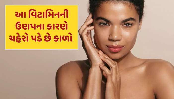 GK Quiz : કયા વિટામિનની ઉણપના કારણે ચહેરાનો રંગ કાળો પડવા લાગે છે ?