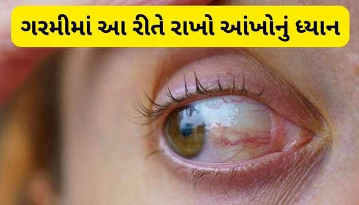 ઉનાળામાં AC કે કૂલરનો વધુ ઉપયોગ કરતા હોવ તો ચેતી જજો, આંખમાં થઈ શકે છે ગંભીર સમસ્યા