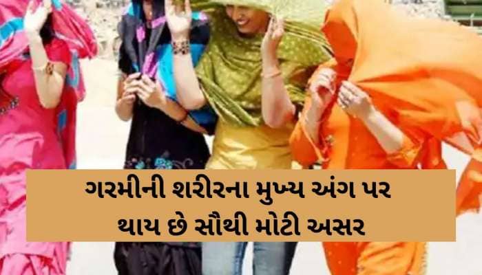 અમદાવાદીઓ સાવધાન! કાળઝાળ ગરમીમાં શરીરના મુખ્ય અંગ પર અસર; કેસમાં 20 ટકાનો વધારો!