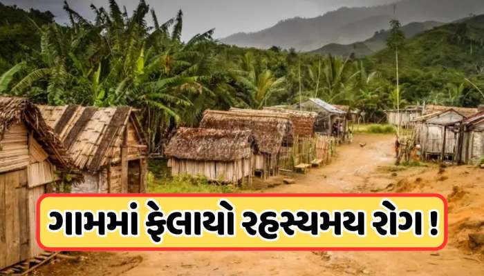 Viral News: ભાઈ-બહેનના લગ્નનો ભયાનક અંત! બાળકોને લાગી ભયાનક બીમારી, જે તેમને ચાલવા પણ કરી દીધી મુશ્કેલી
