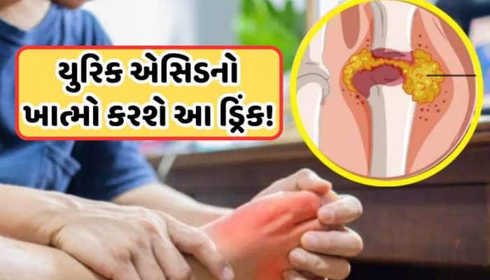 Health Tips: ખાલી પેટ પીઓ આ રસોડાના મસાલાનું પાણી, 21 દિવસમાં યુરિક એસિડ થશે દૂર!