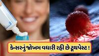 Health Tips: ટૂથપેસ્ટમાં એવું કયું કેમિકલ હોય છે, જેનાથી થઈ શકે છે આંતરડાનું કેન્સર!