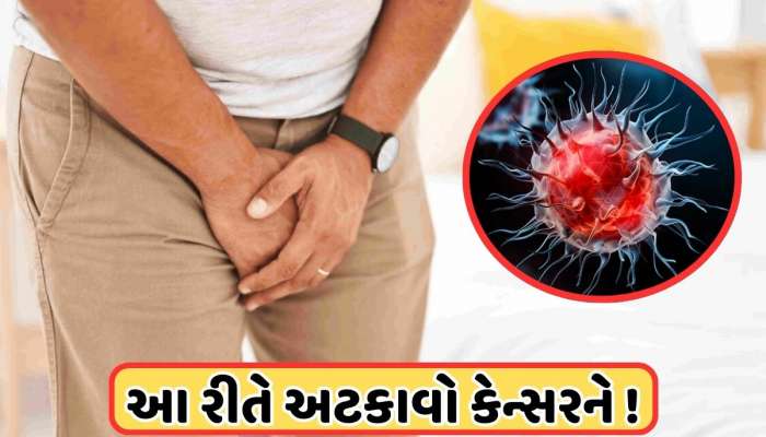 પુરુષો માટે આ 3 સંકેતો પર નજર રાખવી જરૂરી, જીવલેણ બને છે પ્રાઈવેટ પાર્ટનો આ રોગ