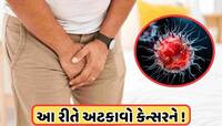 પુરુષો માટે આ 3 સંકેતો પર નજર રાખવી જરૂરી, જીવલેણ બને છે પ્રાઈવેટ પાર્ટનો આ રોગ