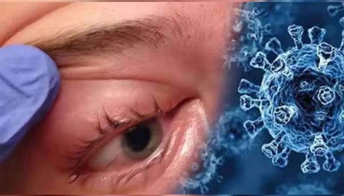 કોરોનાની નવી લહેર વચ્ચે ગુજરાત પર આવ્યું સંકટ, આવ્યા આ બીમારીના દર્દી