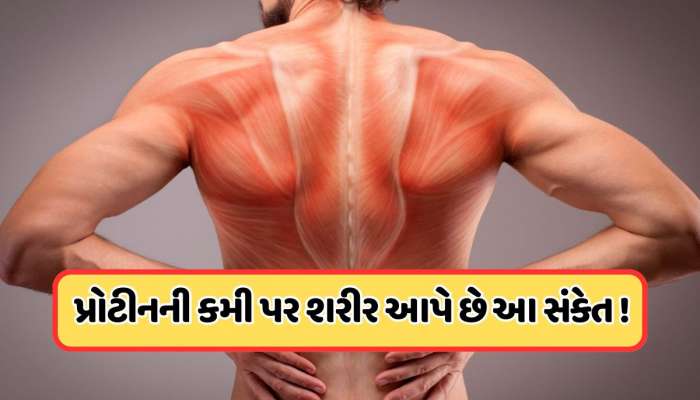 શરીરમાં ઘટી રહ્યું છે પ્રોટીનનું લેવલ, સ્નાયુ તૂટતા પહેલા આ સંકેતોને ઓળખો