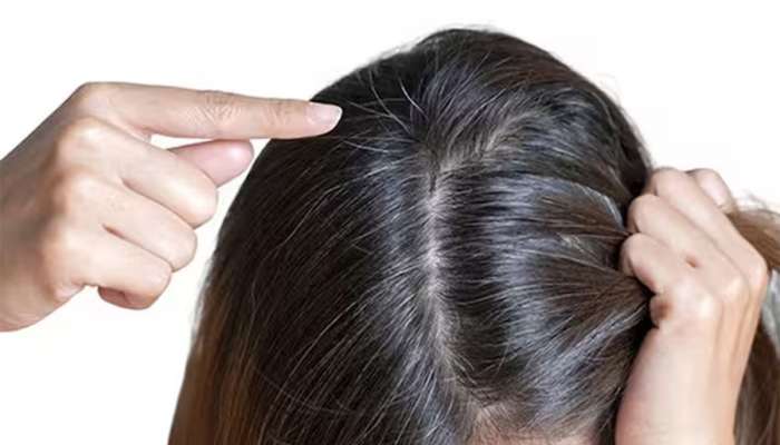 White Hair: 3 નેચરલ વસ્તુથી બનાવો નેચરલ હેર કલર, માથામાં લગાડતાં જ સફેદ વાળ મૂળમાંથી કાળા થઈ જશે 