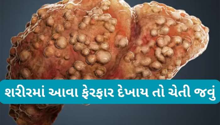 આ અંગોમાં સોજો એટલે ફેટી લિવર બની રહ્યું છે સિરોસિસ, લિવર સડી જાય તે પહેલા કરો આ કામ