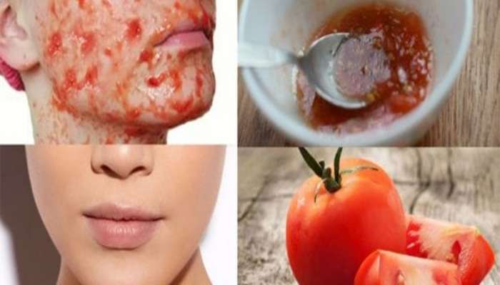 Tanning Removal: તડકાના કારણે થયેલું ટેનિંગ સાફ કરવા ટમેટામાં આ 2 વસ્તુ મિક્સ કરી લગાડો, 10 મિનિટમાં ત્વચા રુપાળી થઈ જશે