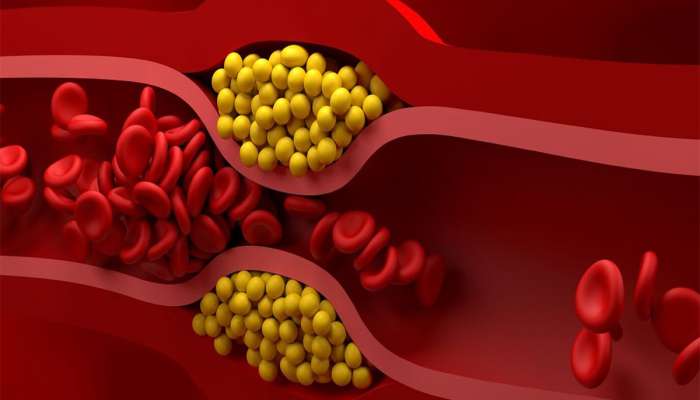 Bad Cholesterol: બેડ કોલેસ્ટ્રોલનો સફાયો કરી નાખશે આ પેસ્ટ, રોજ સવારે 1 ચમચી હુંફાળા પાણી સાથે ખાવી