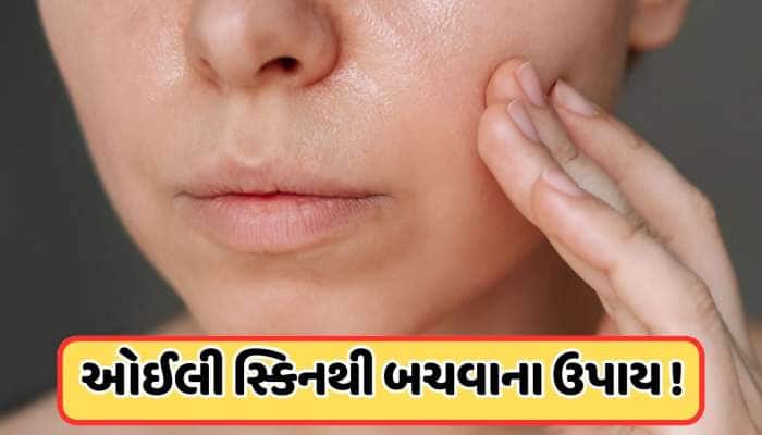 ગરમીમાં ચહેરા પરથી ટપકે છે તેલ તો અપનાવો આ ઉપાયો, ઓઈલી સ્કિનથી મળશે છુટકારો !