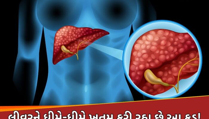 તમારી થાળીમાં છુપાયેલો છે લિવરનો 'કાતિલ', જમતા પહેલા તરત જ હટાવી લો આ વસ્તુ!