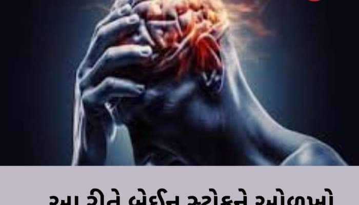 બ્રેઈન સ્ટ્રોક આવે ત્યારે આ 3 લક્ષણો દેખાય છે, ભૂલમાં પણ નજરઅંદાજ ન કરો