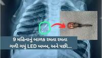 એક પિતાની વેંદના સાંભળીને તમારું હૃદય કંપી જશે! કહ્યું- છેલ્લે સાચી સારવાર તો અમને..
