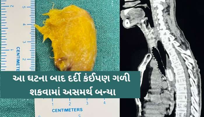 આ 'દાદા'ને કેરીનો સ્વાદ ભારે પડ્યો! ખાતા-ખાતા કેરીનો ગોટલો ગળી ગયા અને પછી થઈ જોવા જેવી.. 